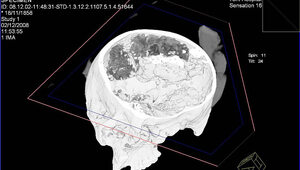 Miniatura: Mózg z Heslington sprzed 2600 lat....
